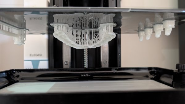 Zahnschiene im 3D Drucker